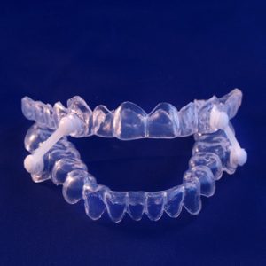 oral appliance for sleep apnea