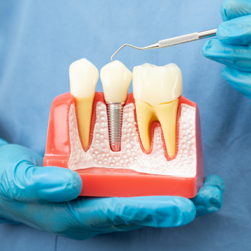 replace missing tooth