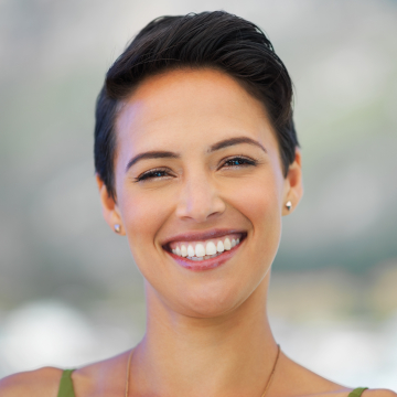 prepless veneers