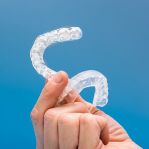 clear aligners