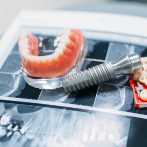 implant dentures