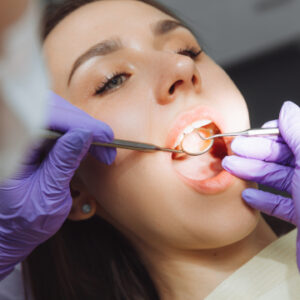 amalgam removal