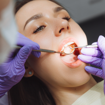 amalgam removal