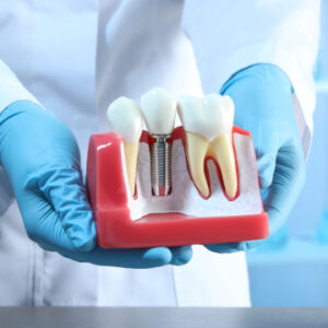 dental implants help