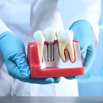dental implants help